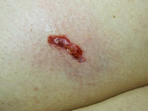 after txstorecrash-33